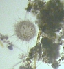 amoeba_actinosphaerium(2).jpg