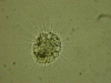 amoeba_actinosphaerium.jpg