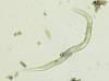 Nematode (9).JPG