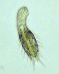 Photograph of a gastrotrich