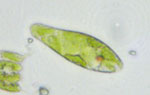 Photograph of a protozoan